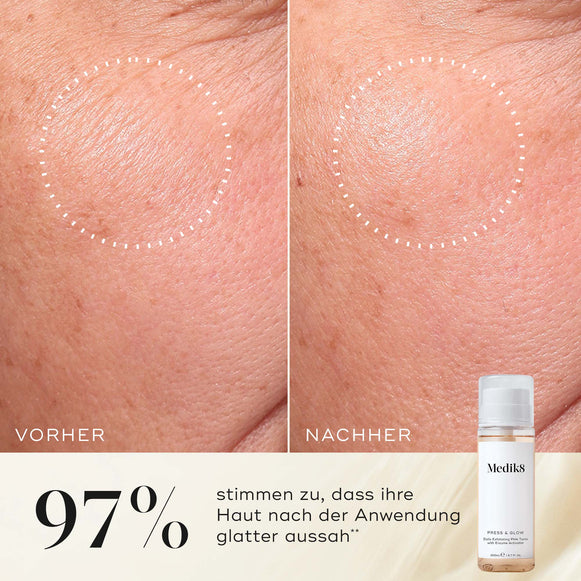 Nahaufnahme der Wange einer Teilnehmerin vor und nach der Anwendung, die eine glattere Textur und ein gleichmäßigeres Erscheinungsbild zeigt. Die Medik8 Press & Glow-Tonikflasche ist in der Ecke zu sehen. Der Text hebt hervor: „97 % stimmen zu, dass ihre Haut nach der Anwendung glatter aussah.“-hover-39
