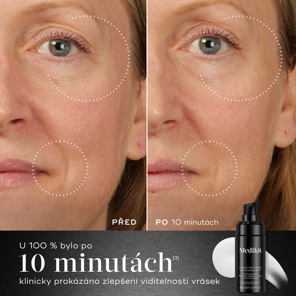 10 minuty – Srovnání „před a po“ obličeje účastníka zobrazené vedle lahvičky Medik8 Liquid Peptides Advanced MP ukazuje snížení vrásek v oblasti očí a úst. Text zdůrazňuje, že 100 % účastníků vykázalo klinické zlepšení viditelných vrásek během 10 minut.-hover-4