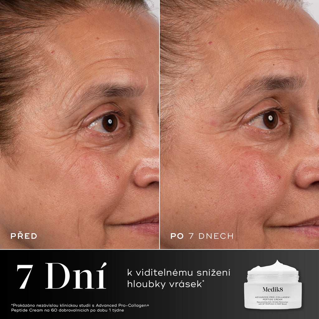 7 dní – Porovnání oblasti kolem očí účastnice před a po 7 dnech, zobrazené vedle balení krému Medik8 Advanced Pro-Collagen+ Peptide Cream. Text zdůrazňuje, že bylo prokázáno, že tento produkt viditelně snižuje hloubku vrásek za 7 dní.