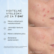 Detailní snímky tváře „Před“ a „Po 4 týdnech“ vedle sebe zobrazují pleť se zarudnutím a nerovnoměrnou texturou.
Text pod obrázkem uvádí:
„Klinicky prokázáno, že viditelně redukuje zarudnutí a zlepšuje zdraví kožní bariéry.“*