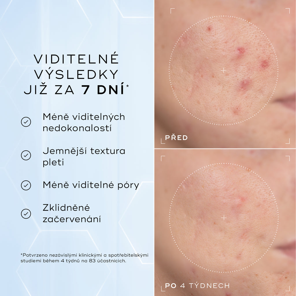 Detailní snímky tváře „Před“ a „Po 4 týdnech“ vedle sebe zobrazují pleť se zarudnutím a nerovnoměrnou texturou.
Text pod obrázkem uvádí:
„Klinicky prokázáno, že viditelně redukuje zarudnutí a zlepšuje zdraví kožní bariéry.“*