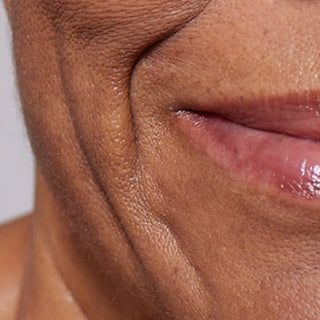 Detailní záběr (makrofotografie) zobrazující viditelný nedostatek pevnosti a elasticity pleti kolem úst a čelisti osoby. Pod obrázkem je jasný text, který tento kožní problém označuje jako „Pevnost“.